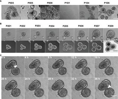 Development of Bovine Gastric Organoids as a Novel In Vitro Model to Study Host-Parasite Interactions in Gastrointestinal Nematode Infections